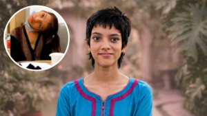 Surgery for Pakistani Girl